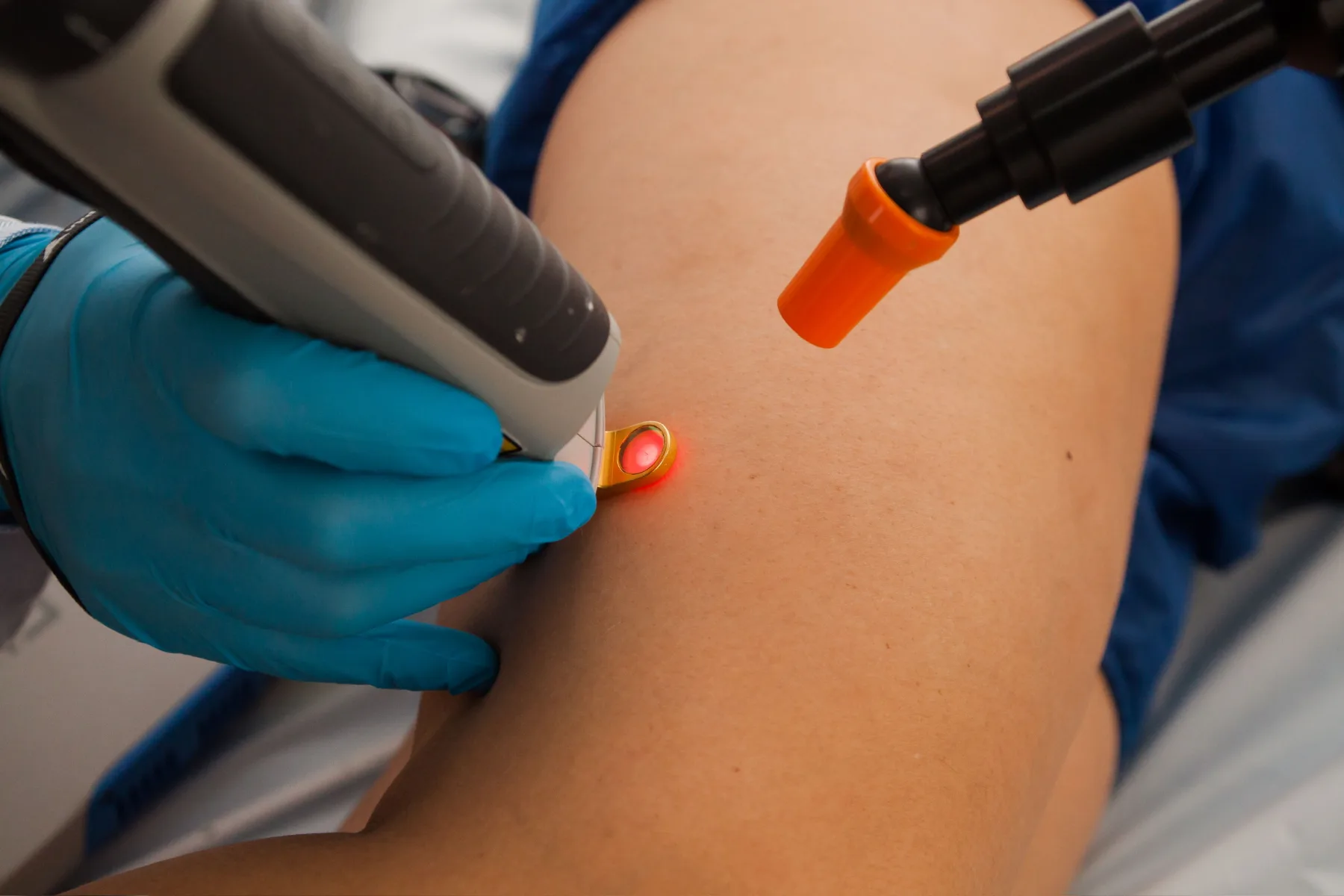 Aplicação de laser transdérmico na perna de uma paciente, na Clínica AngioGold.