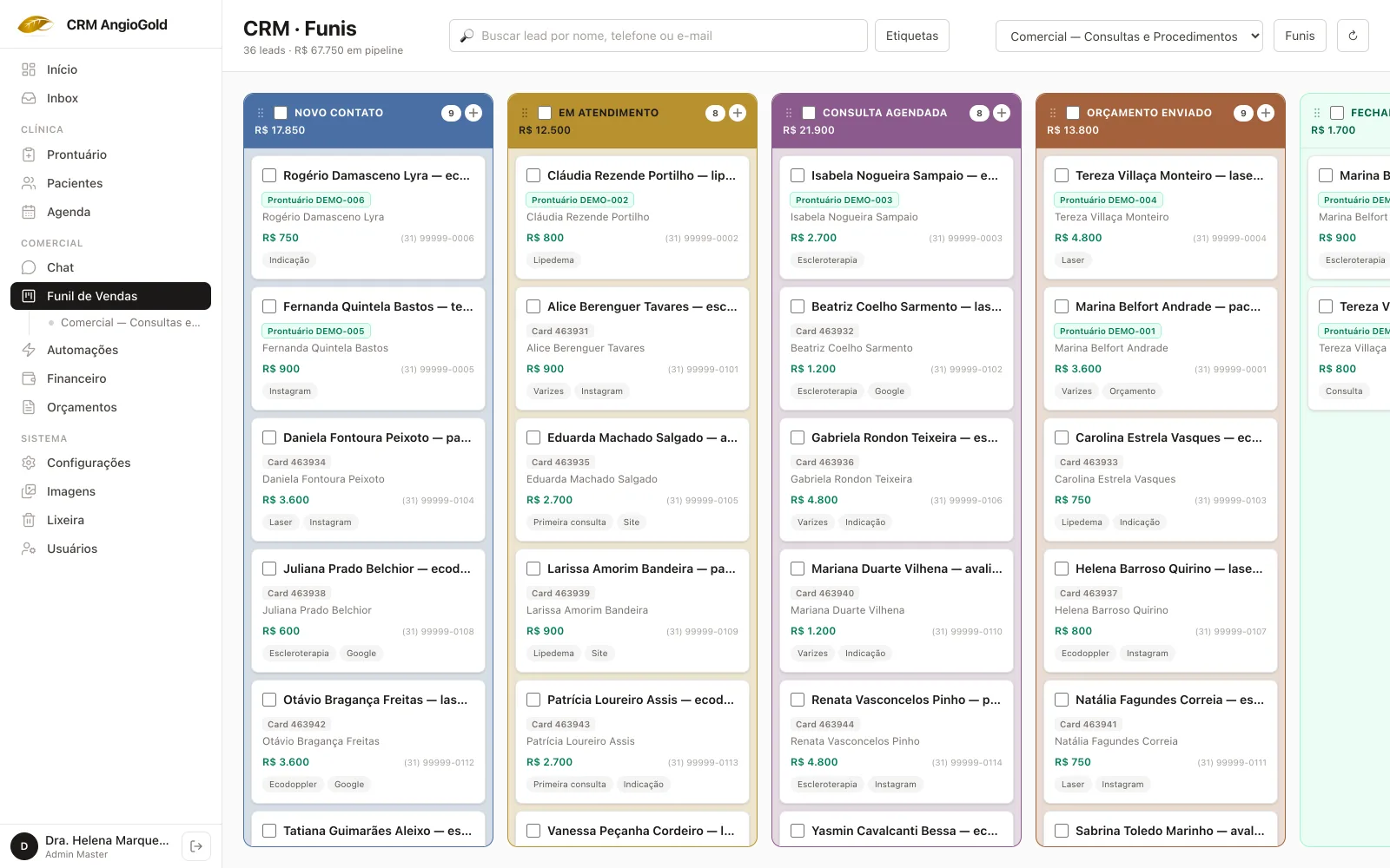 Tela do funil de vendas do CRM AngioGold: quadro com as etapas Novo contato, Em atendimento, Consulta agendada e Orçamento enviado, com cards de pacientes fictícias.